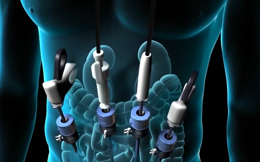 ky开元集团|手机品牌“坚果”正式公布新LOGO